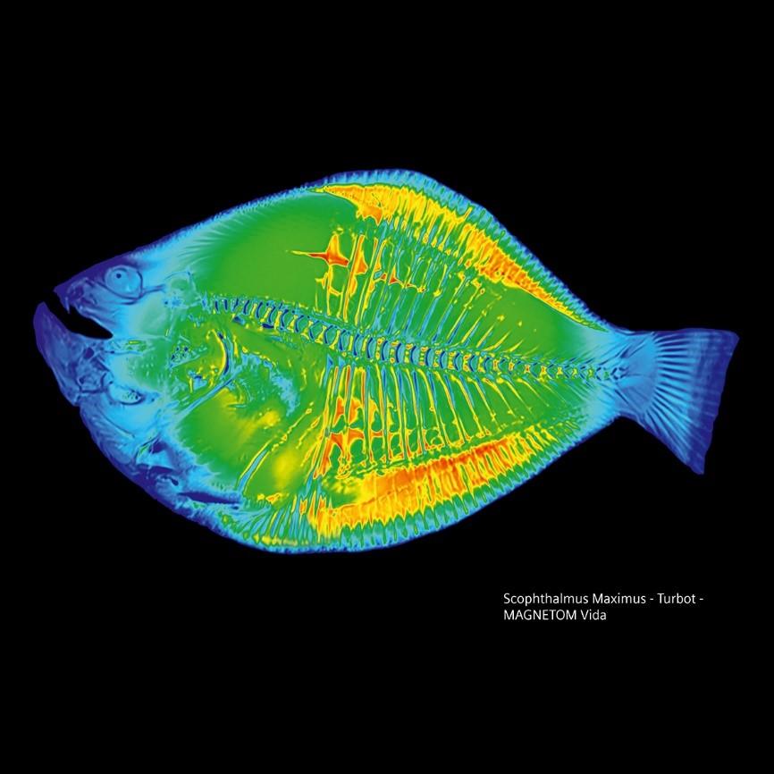 Siemens-healthineers_Magnetomworld_Turbot_Vida.jpg