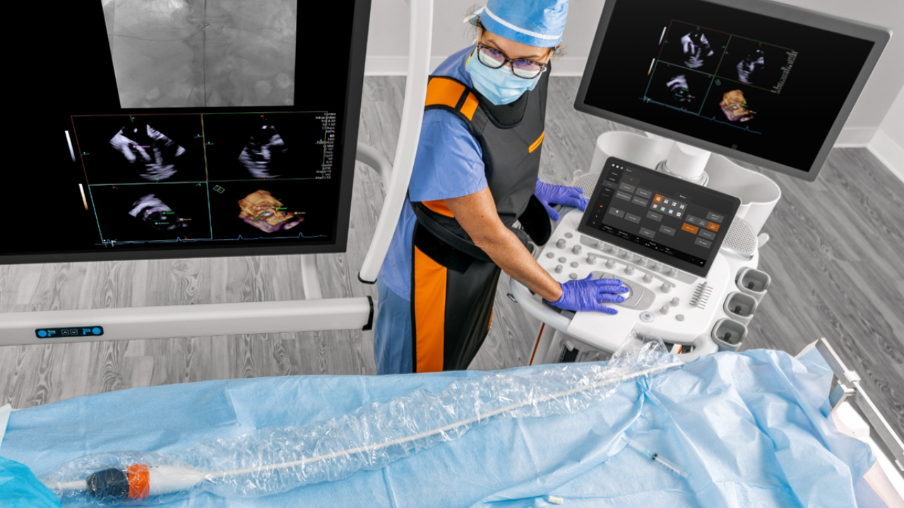 Image of the AcuNav Catheter being used in a cath lab