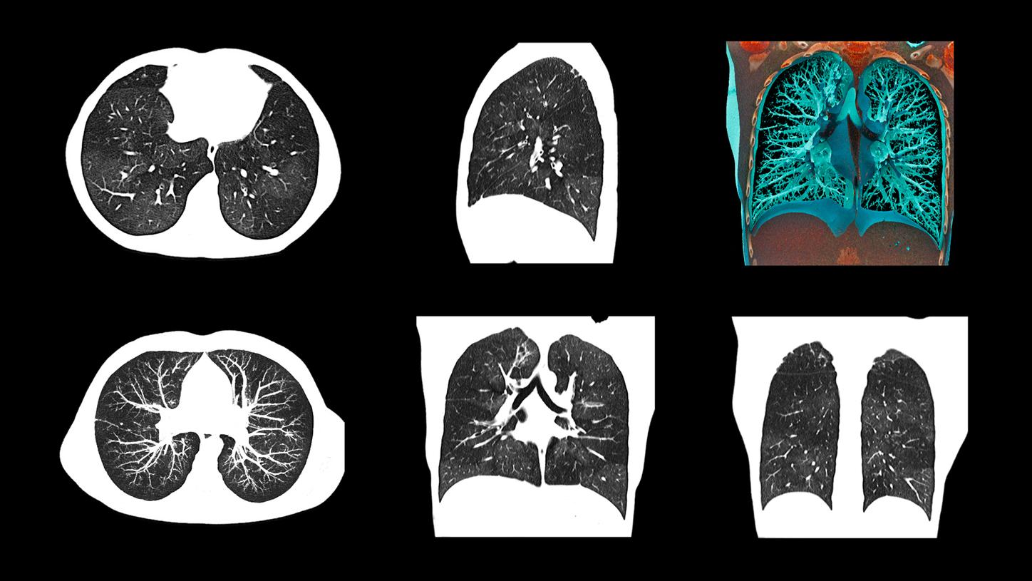 SOMATOM Edge Plus - Clinical Image