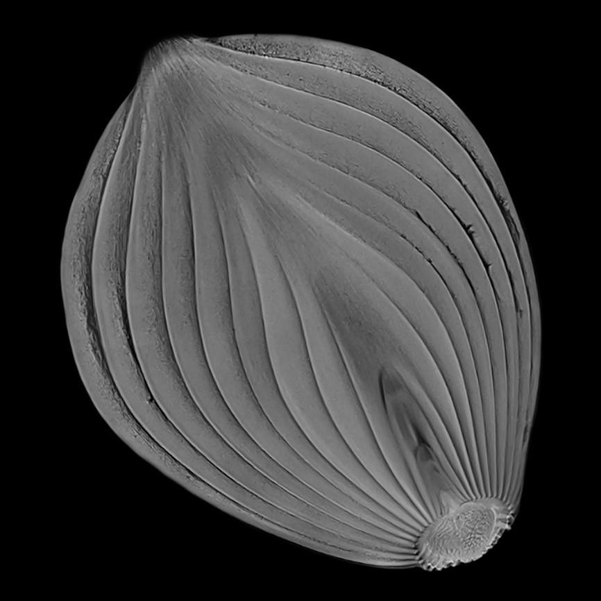 Siemens-healthineers_Magnetomworld_Onion_CimaX