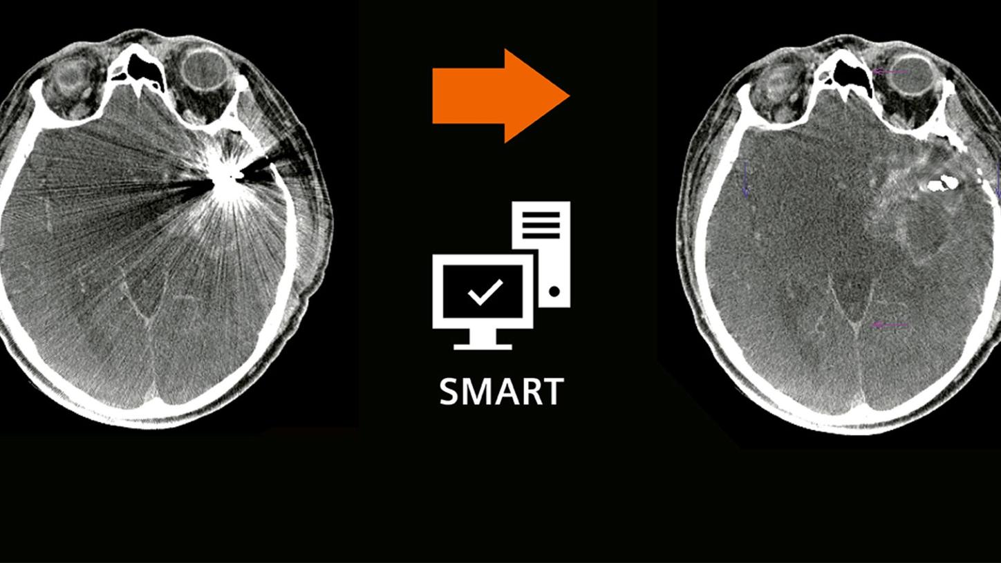 syngo DynaCT SMART