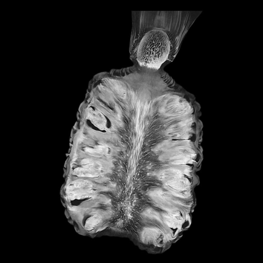 Siemens-healthineers_Magnetomworld_Pineapple_CimaX