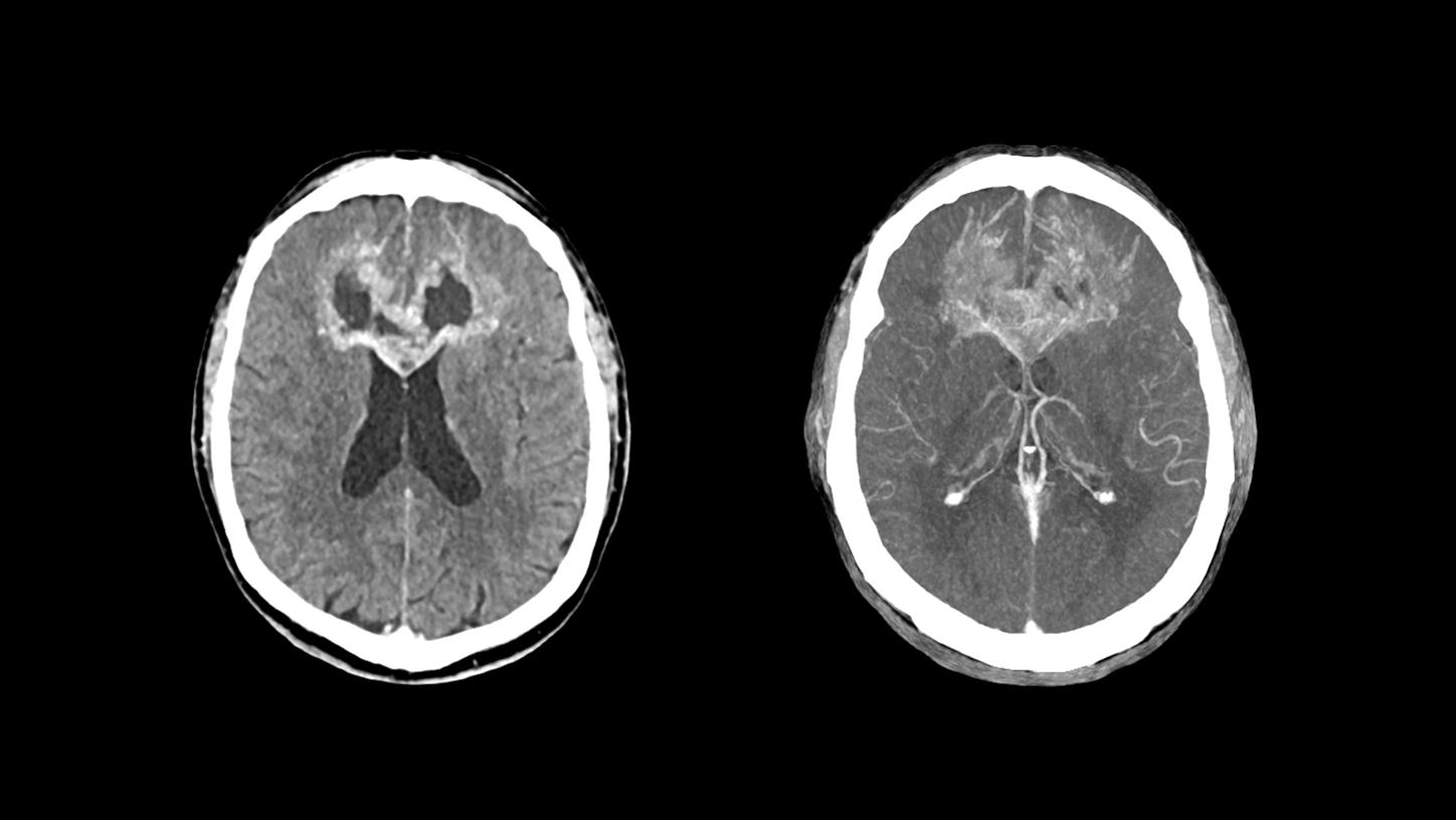 SOMATOM Edge Plus - Clinical Image