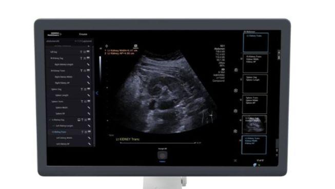 acuson sequoia ultrasound system ai abdomen 3.1