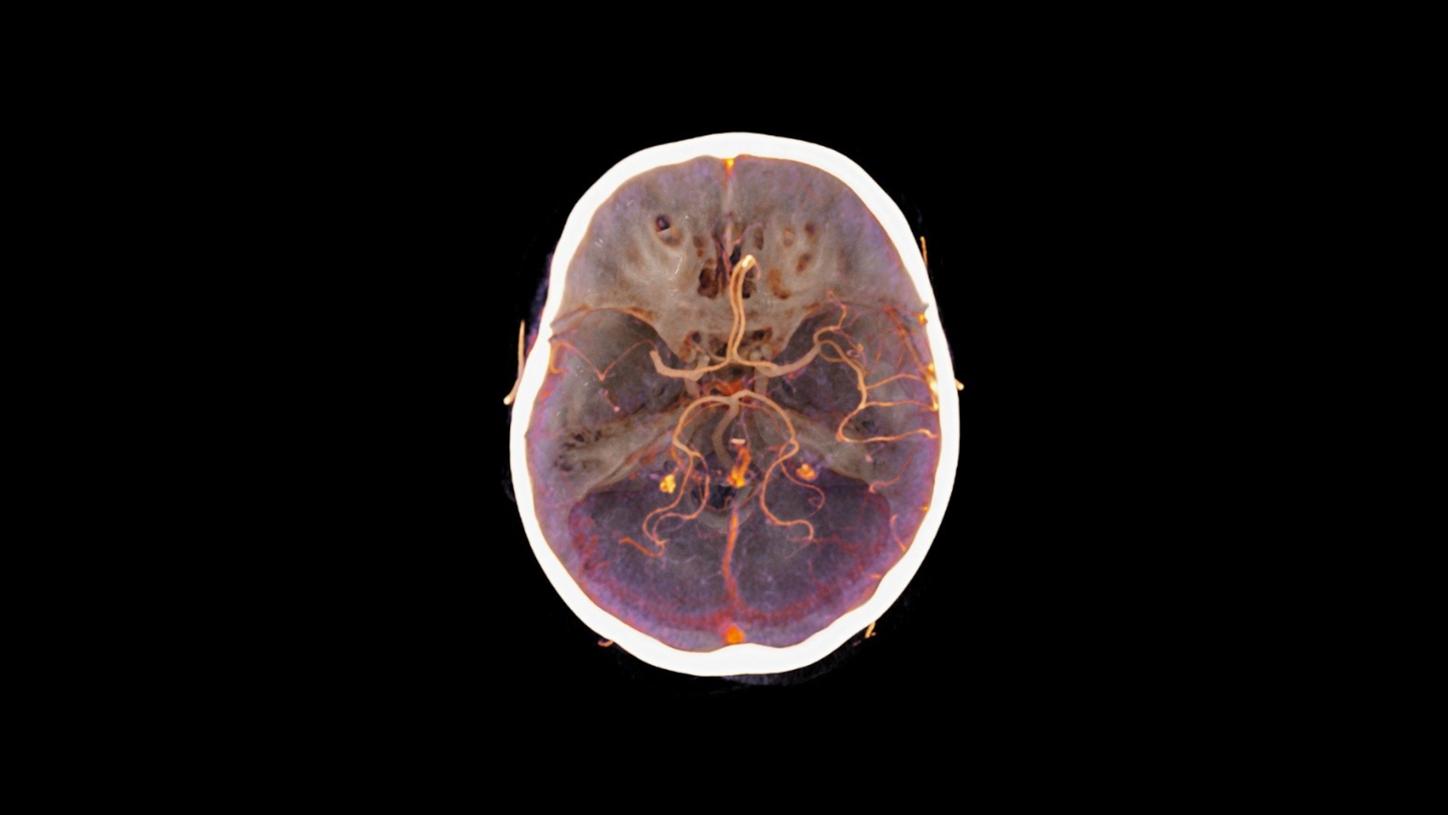 Clinical Specialties Stroke Focus