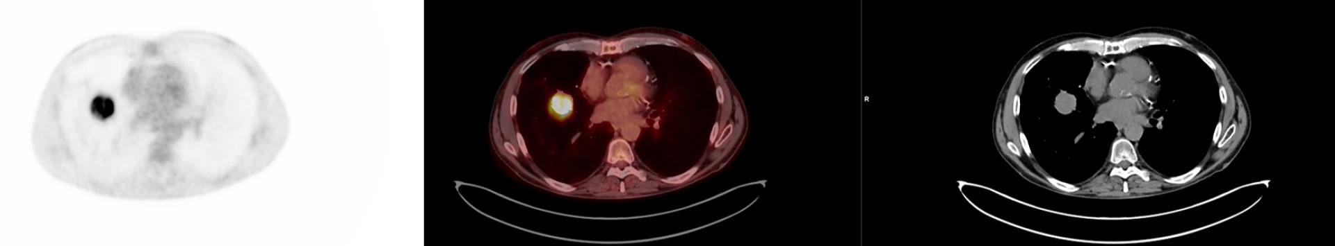 The right PET/CT for a diverse portfolio - Siemens Healthineers USA