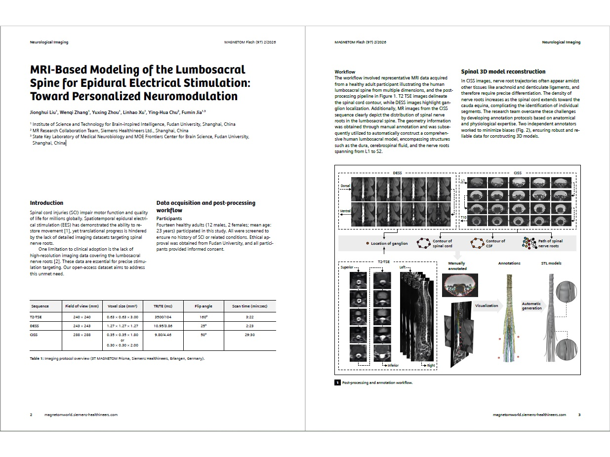 Siemens-healthineers_Magnetomworld_-Nerve-Roots