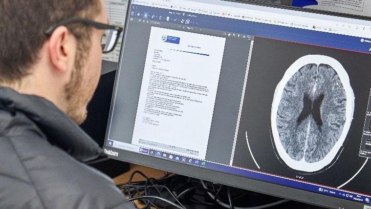 Radiologist in front of a screen with brain image