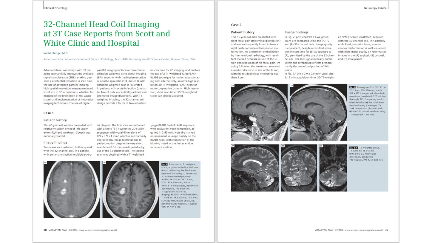 siemens-healthineers_Magnetomworld_32-Channel-Head-Coil-Imaging