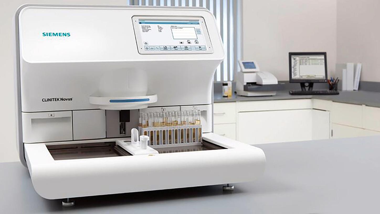 尿酸尿検査はなぜ行われるのですか?