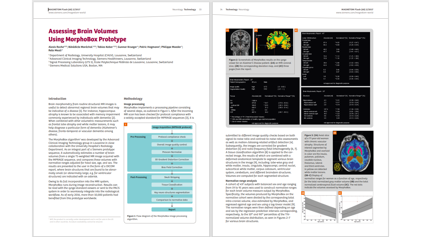 Siemens-healthineers_Magnetomworld_BrainVolume