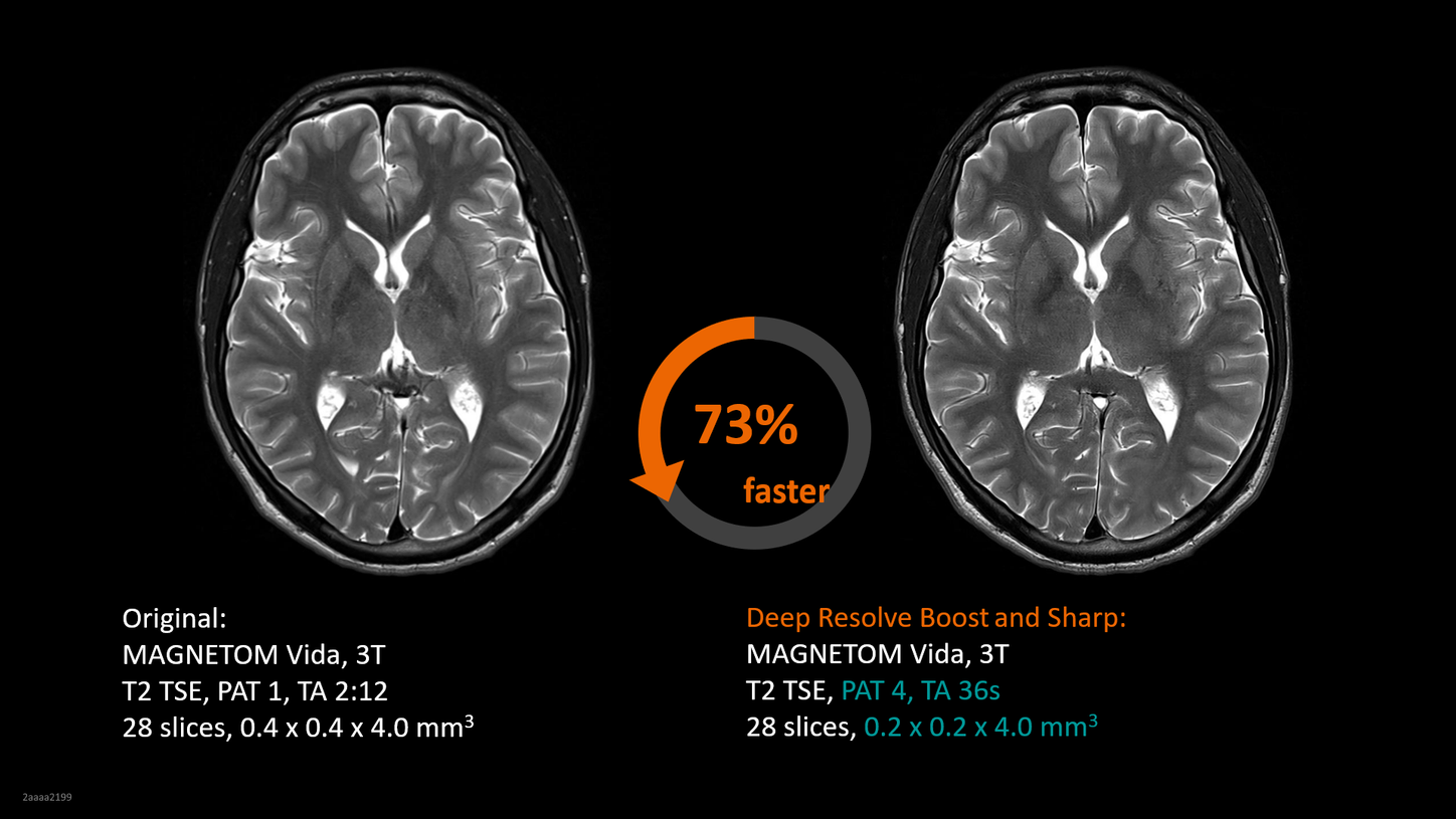 MRI Contrast Agents Clinical Applications 