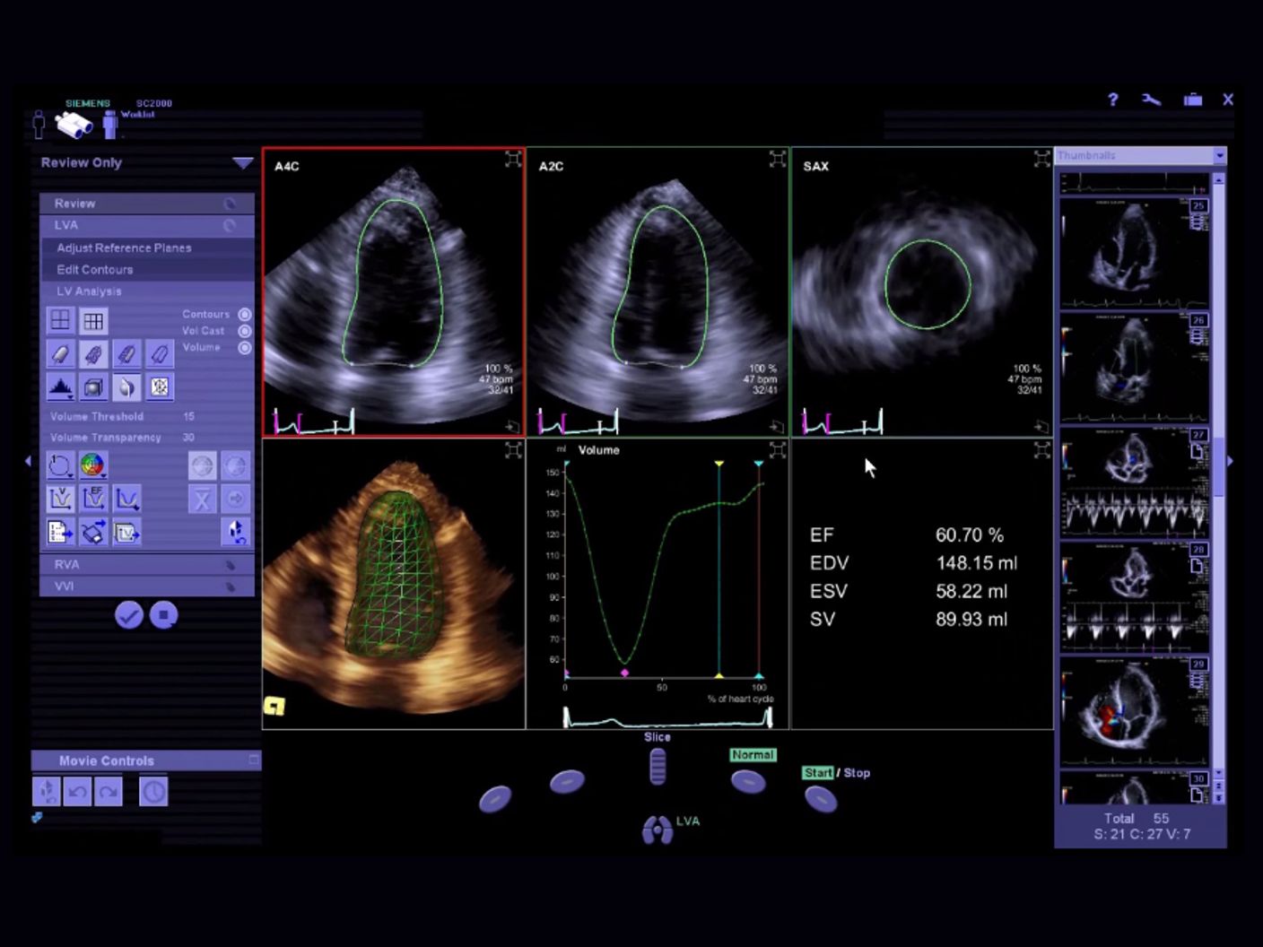 eSie Scan ultrasound imaging interface