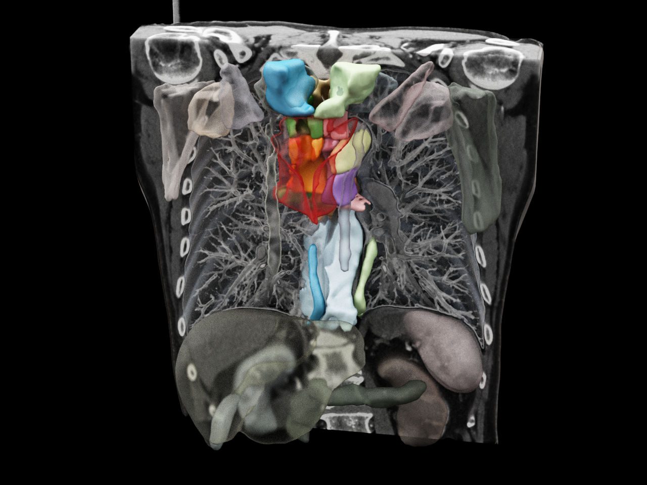 Autocontouring results are generated by Siemens Healthineers