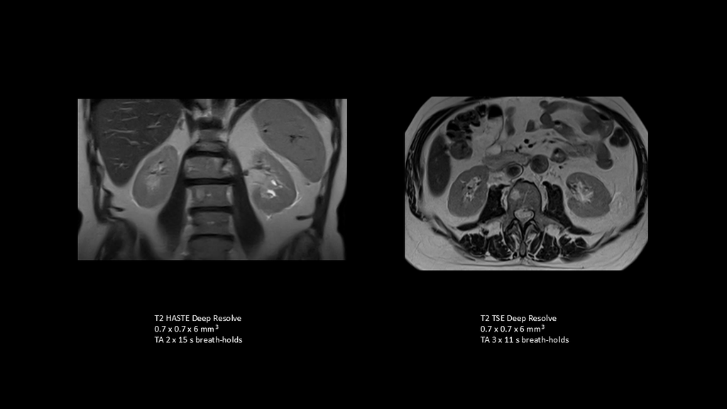 MAGNETOM Free.XL – Leading the way - Siemens Healthineers