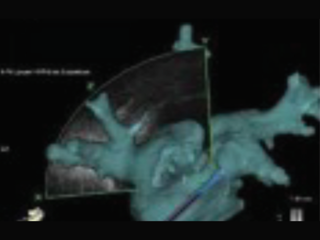 First in 3D ICE imaging
