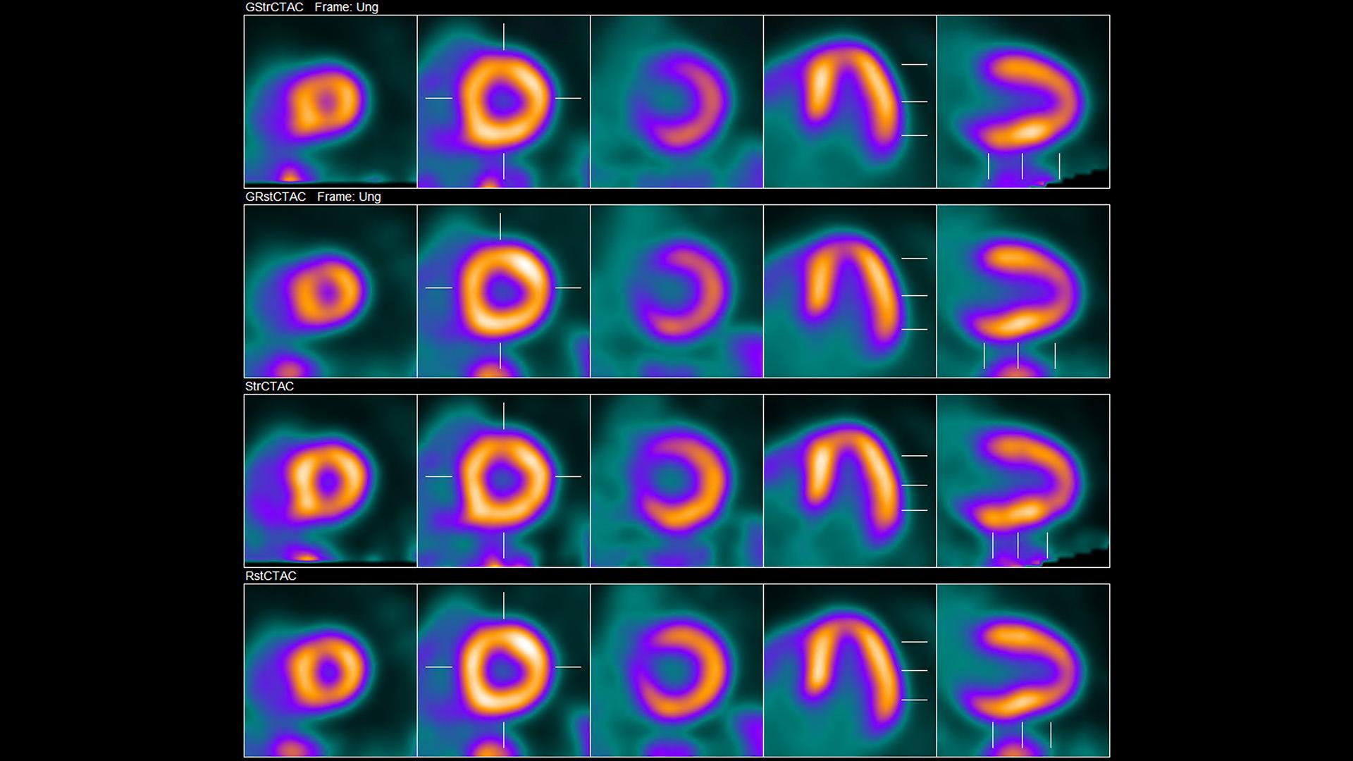 Biograph PET/CT family - Siemens Healthineers