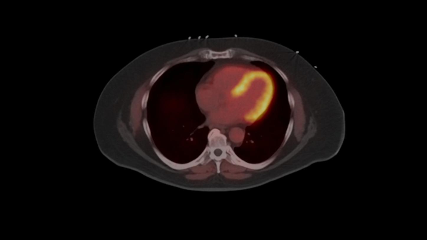 Biograph Trinion Clinical gallery
