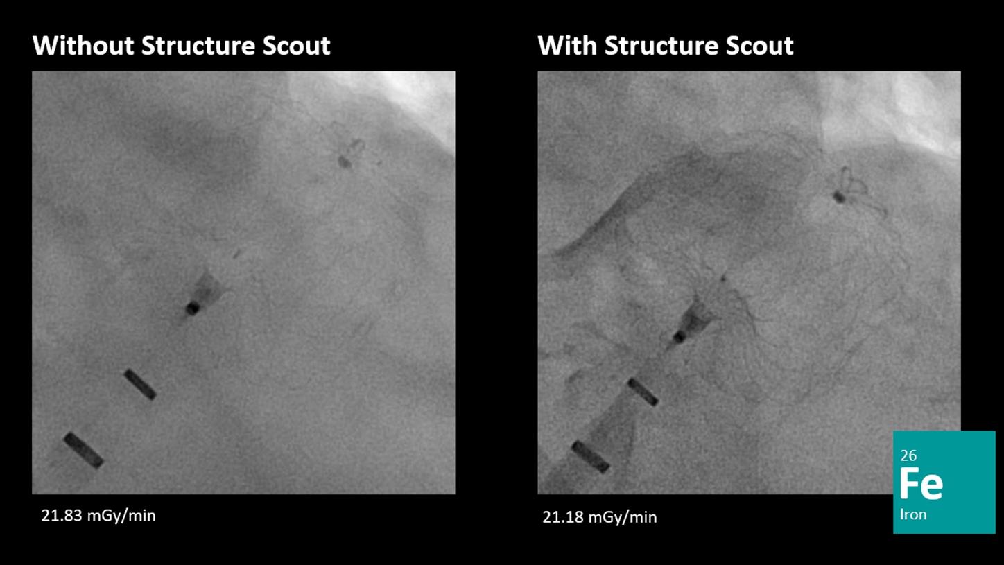 ARTIS icono Structure Scout