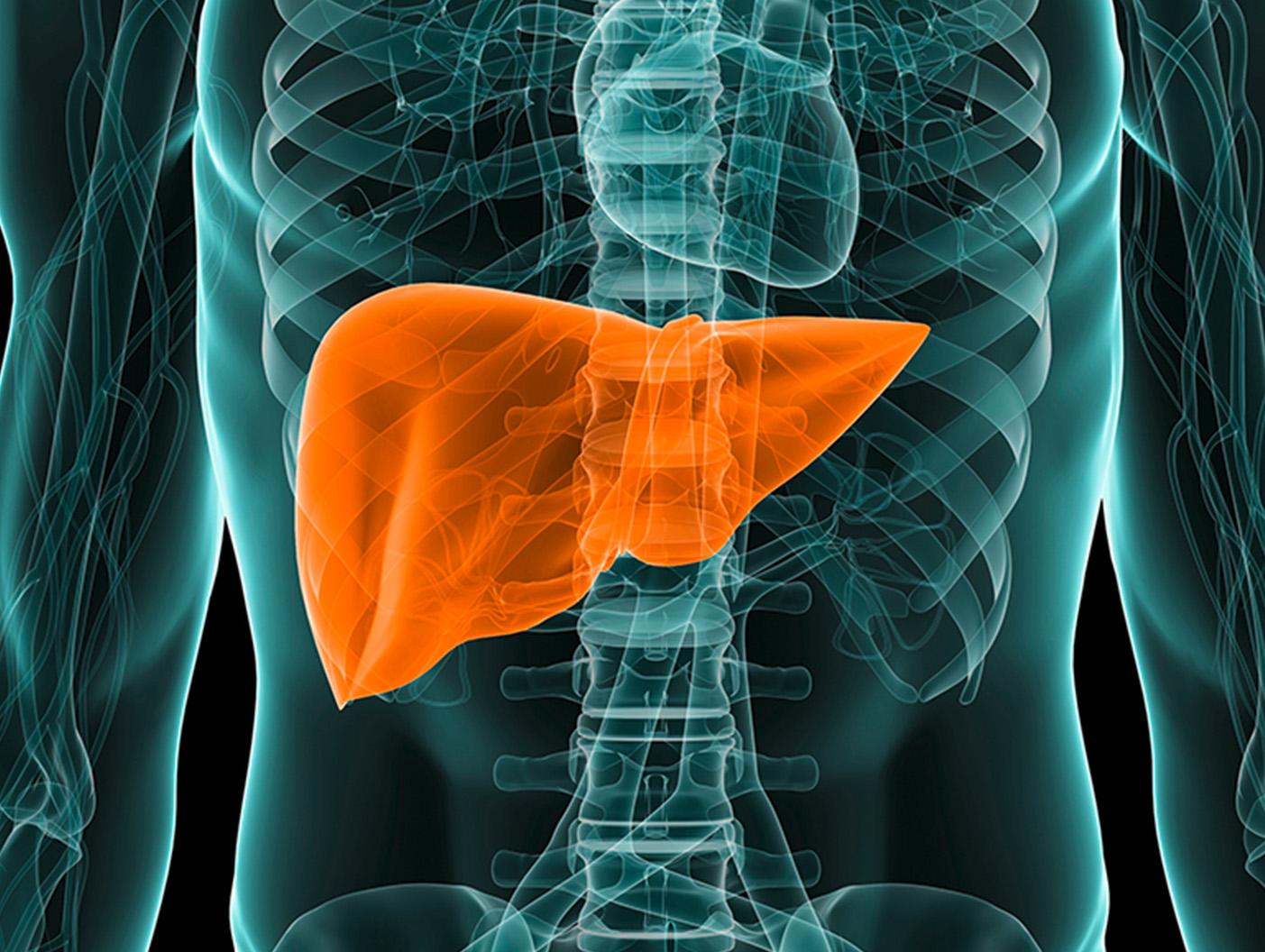 Expanded use of the ELF test can improve access to liver fibrosis testing and reduce carbon emissions