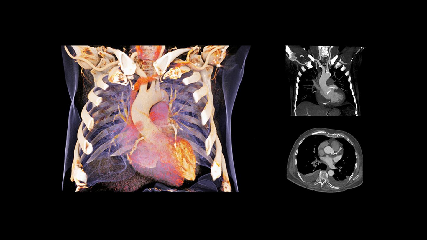 Cardiac Imaging