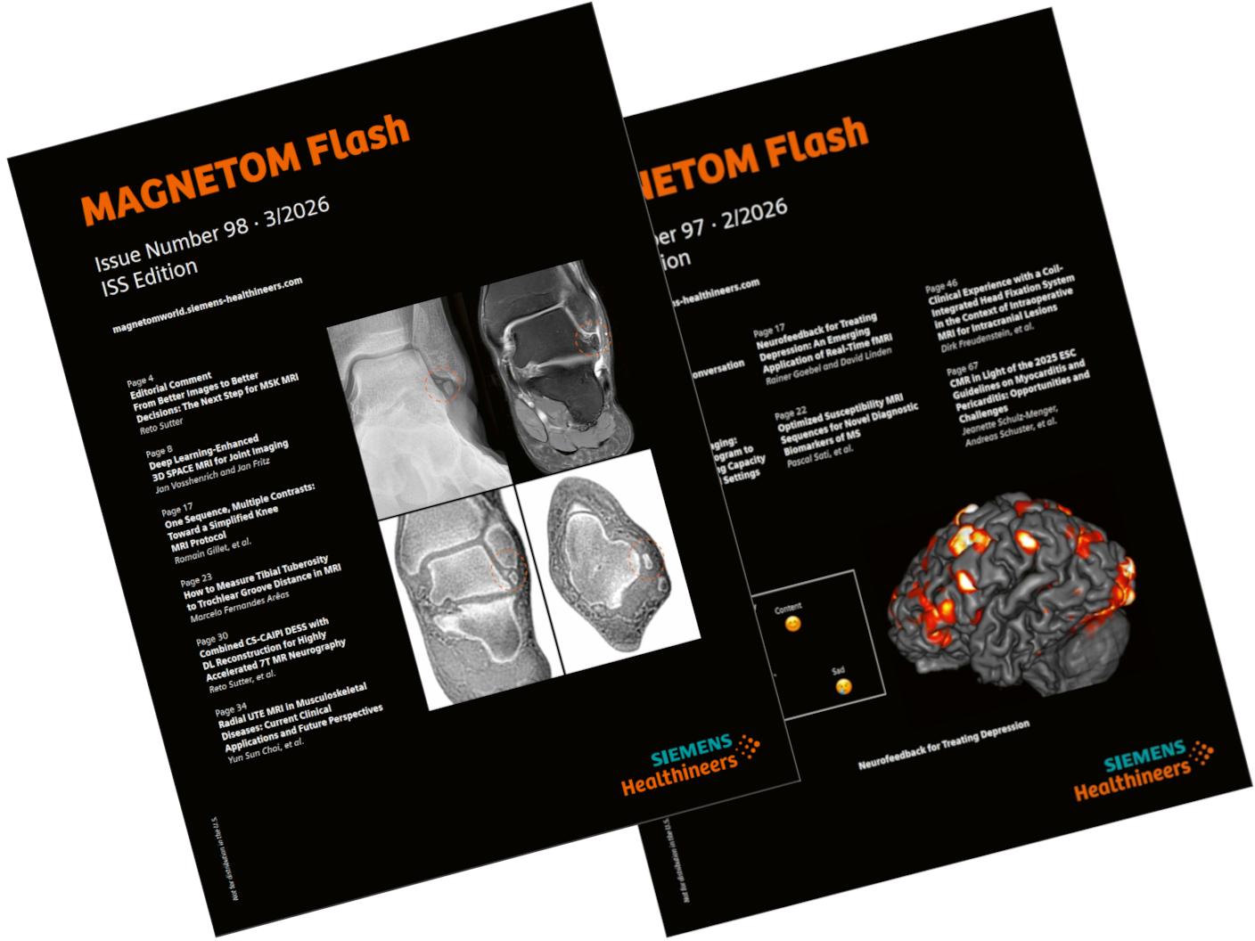 MAGNETOM Flash<br /><br />