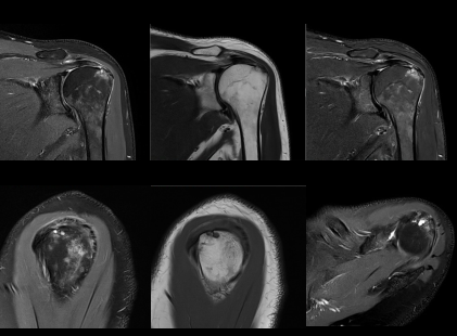 Clinical Case Shoulder