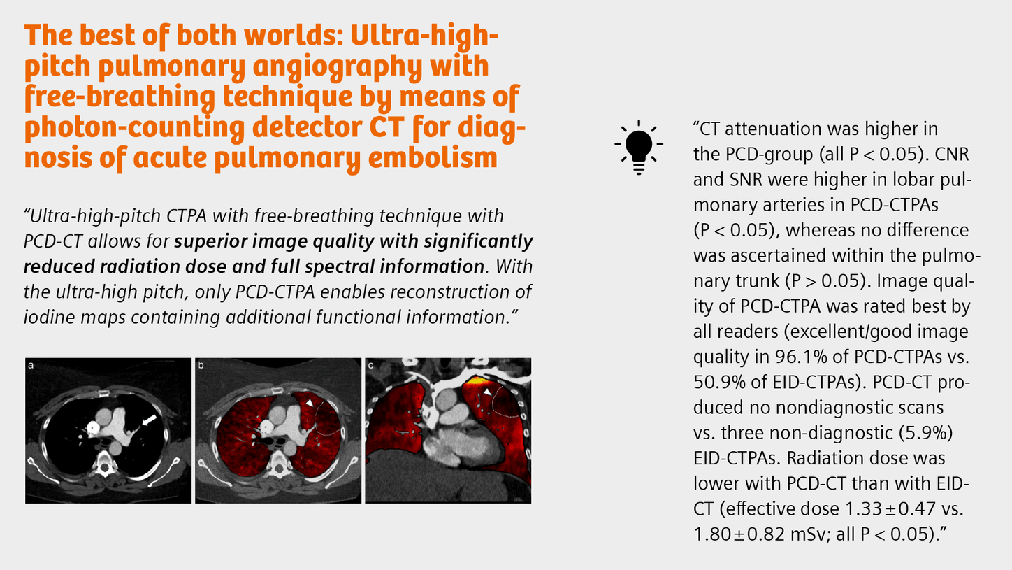Summary of the publication "The best of both worlds: Ultra-high-pitch pulmonary angiography with free-breathing technique by means of photon-counting detector CT for diagnosis of acute pulmonary embolism"