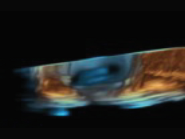 first in 4D ICE imaging