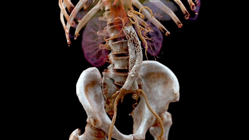 Cinematic Rendering in medical imaging - Siemens Healthineers