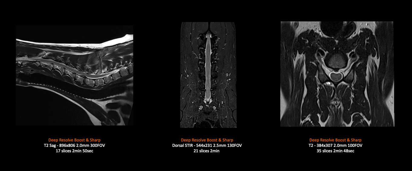 MAGNETOM Sempra – 38kg Dog Spine (8Ch Large Flex)