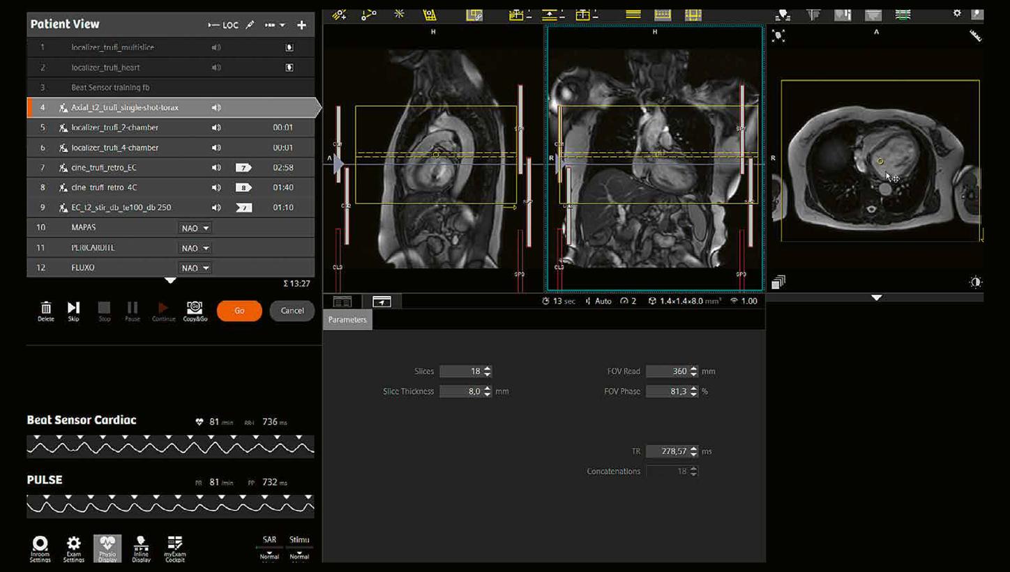 Clinical case MRI Cardiology imaging 2026
