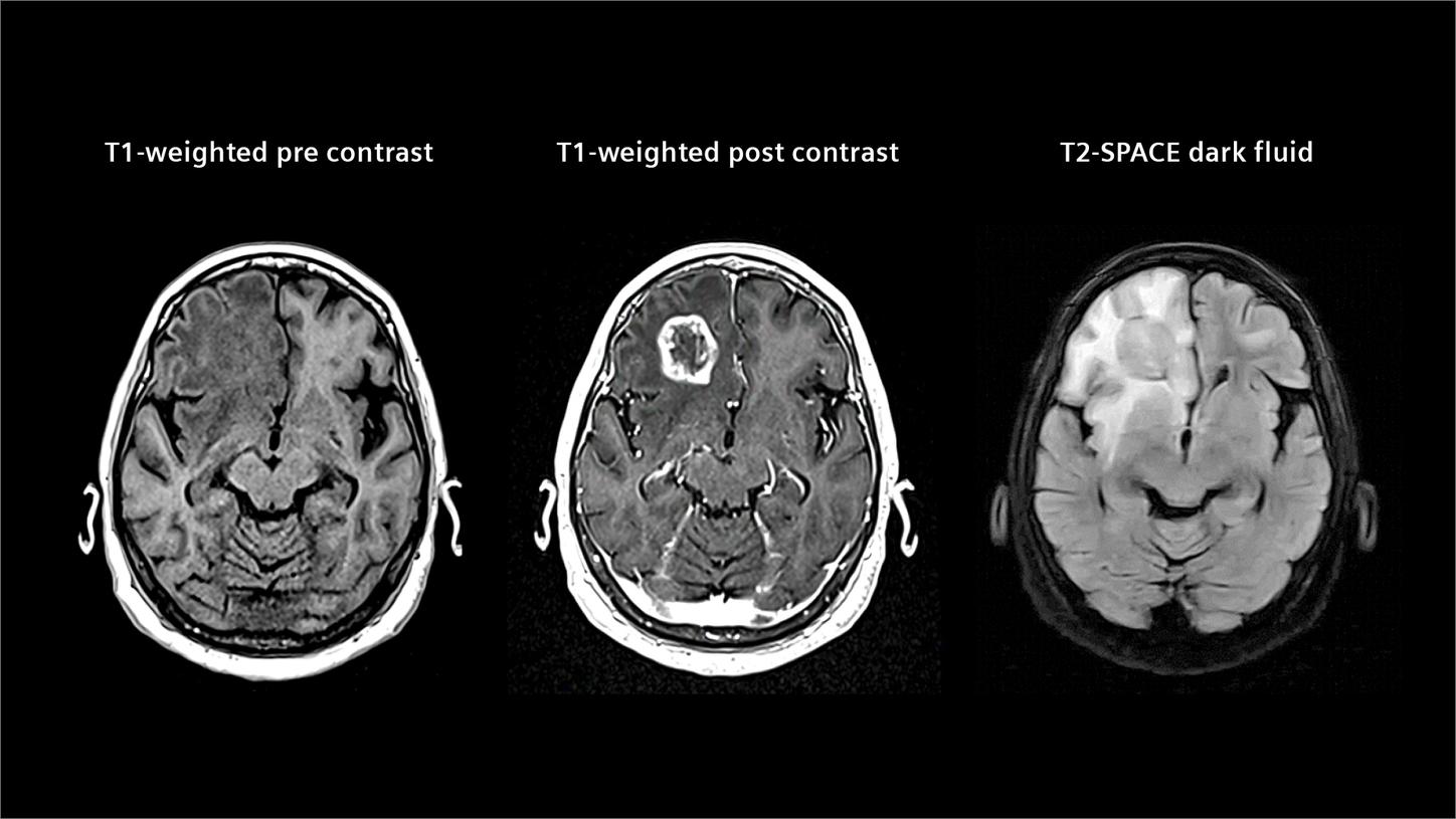 High-resolution brain image