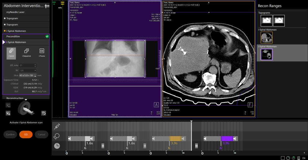 CT scanner SOMATOM go All eco with myExam Companion - Siemens Healthineers
