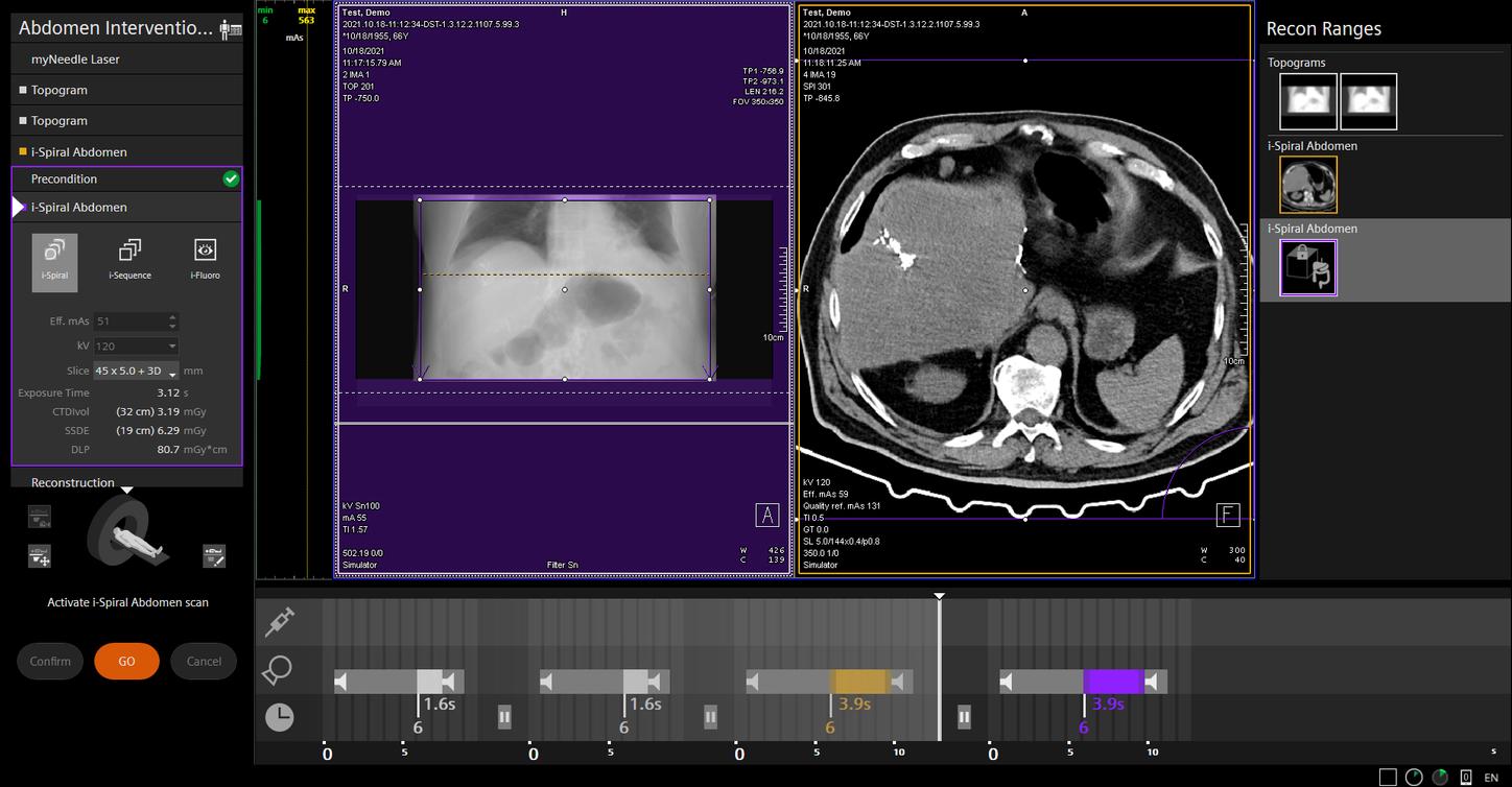FAST i-Sequence with SOMATOM go.All