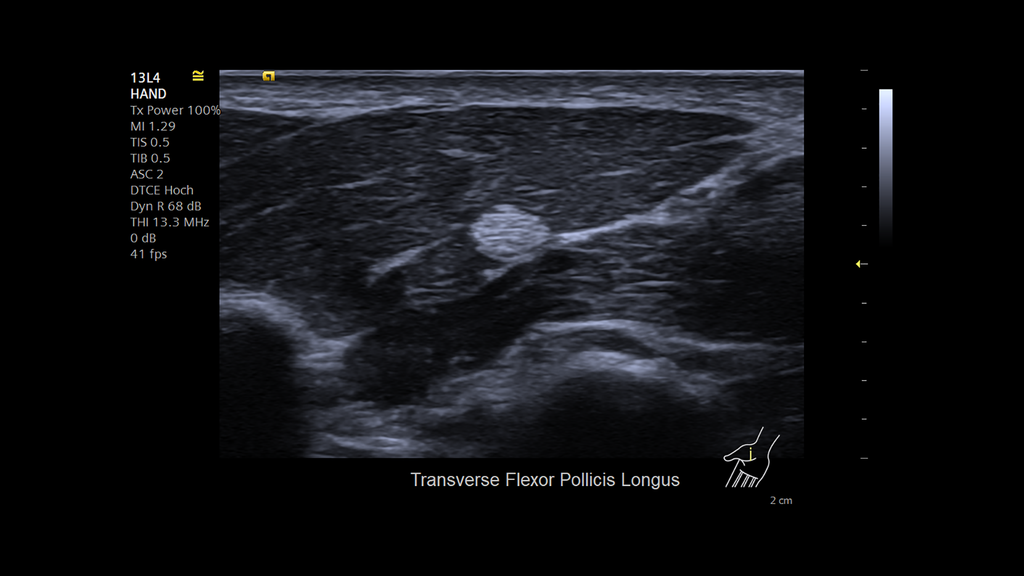 ACUSON Juniper Ultrasound System Siemens Healthineers USA