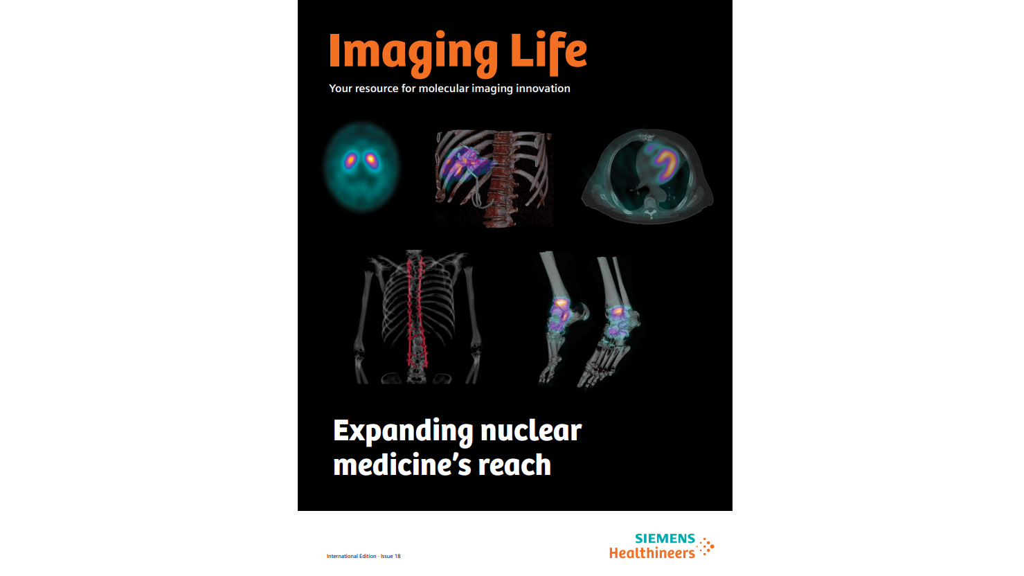 Molecular Imaging Systems - Siemens Healthineers USA
