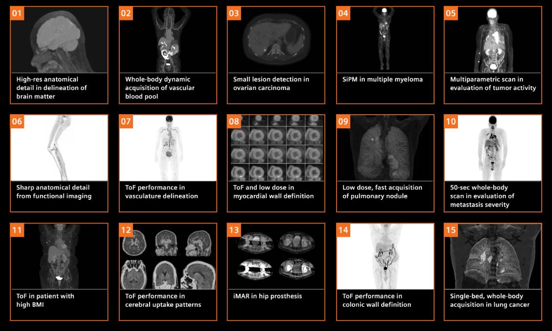 MI Biograph Vision clinical gallery overview