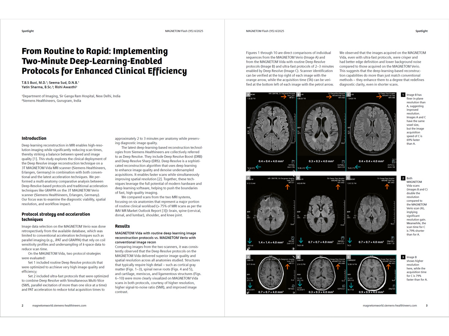 Siemens-healthineers_Magnetomworld_Seema-Sud