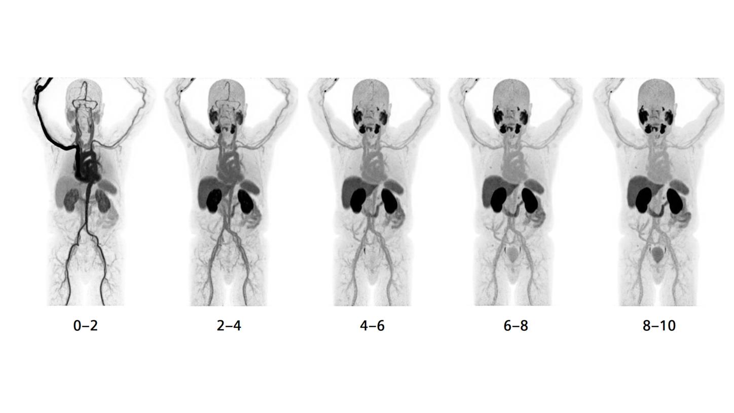 Example of whole-body dynamic PET imaging.