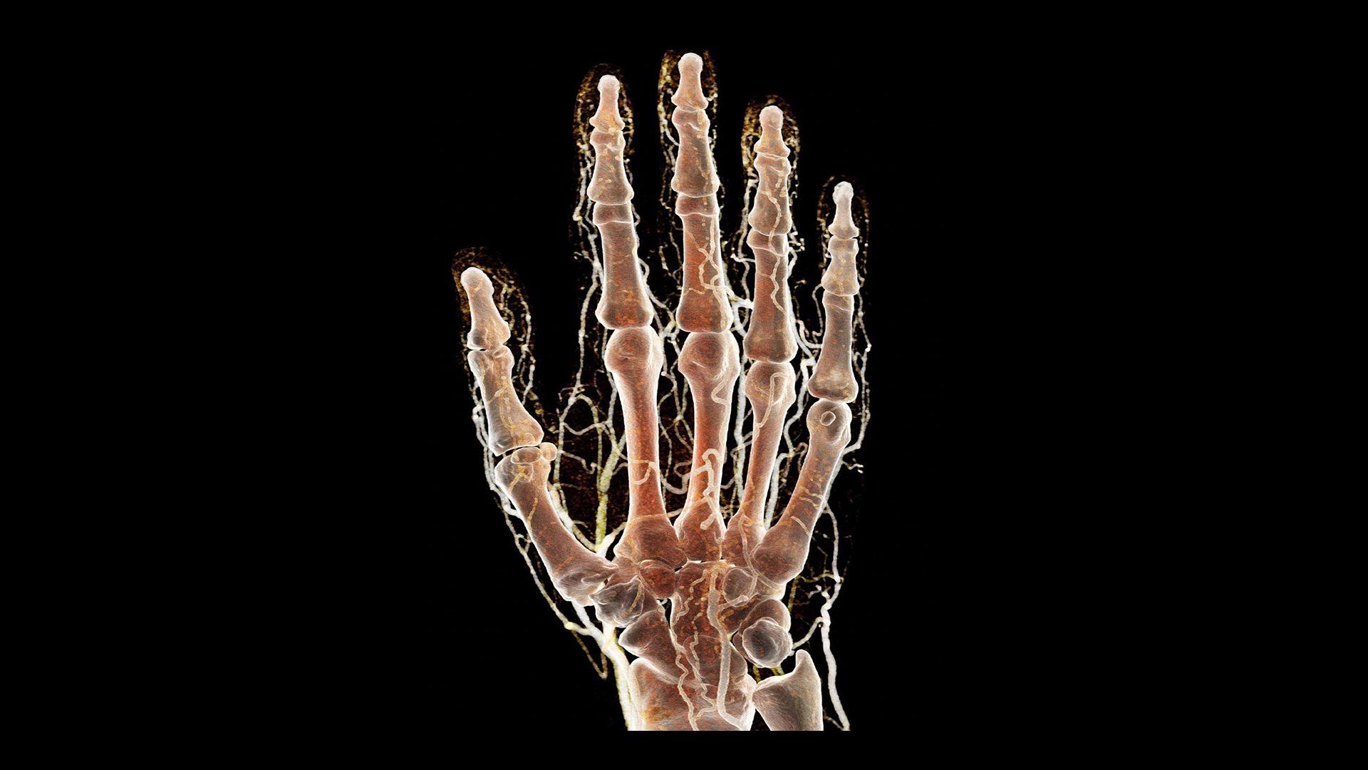 naeotom-alpha-pro-siemens-healthineers