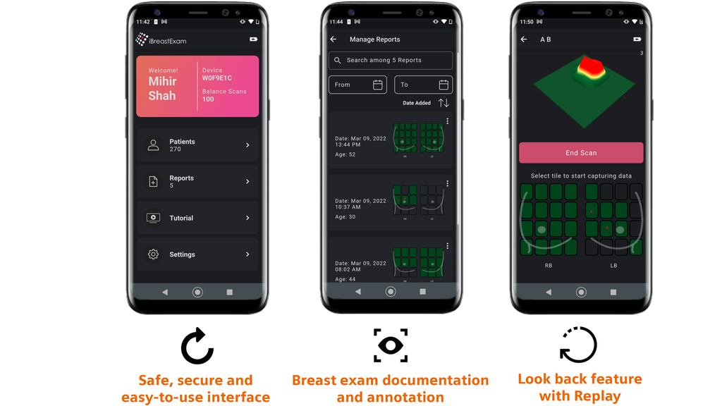 iBreastExam Siemens Healthineers USA