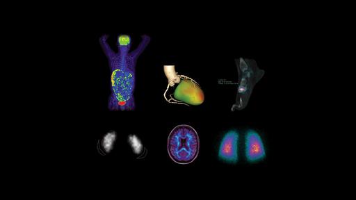 syngo.via - Siemens Healthineers USA