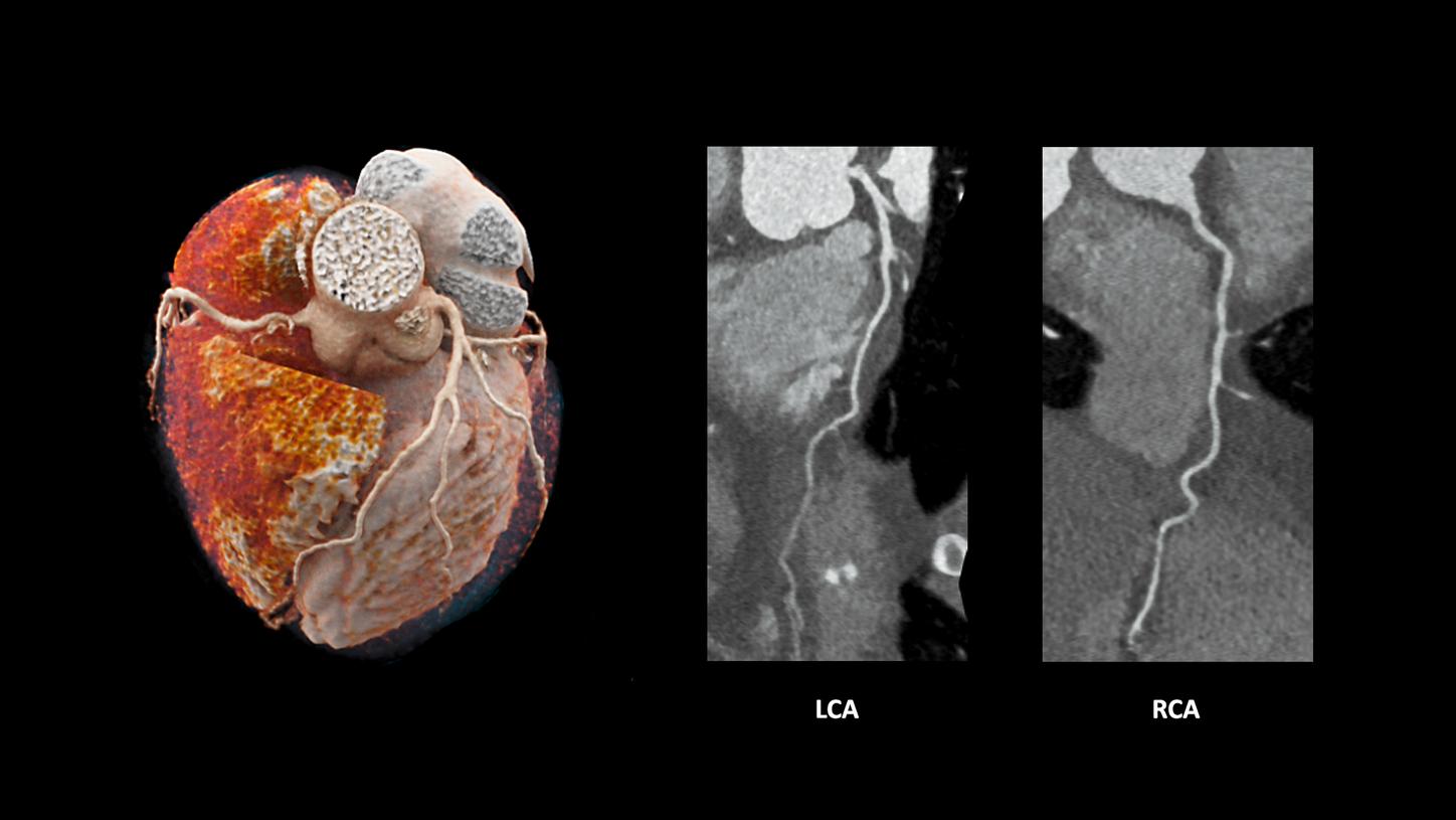 SOMATOM Edge Plus - Clinical Image