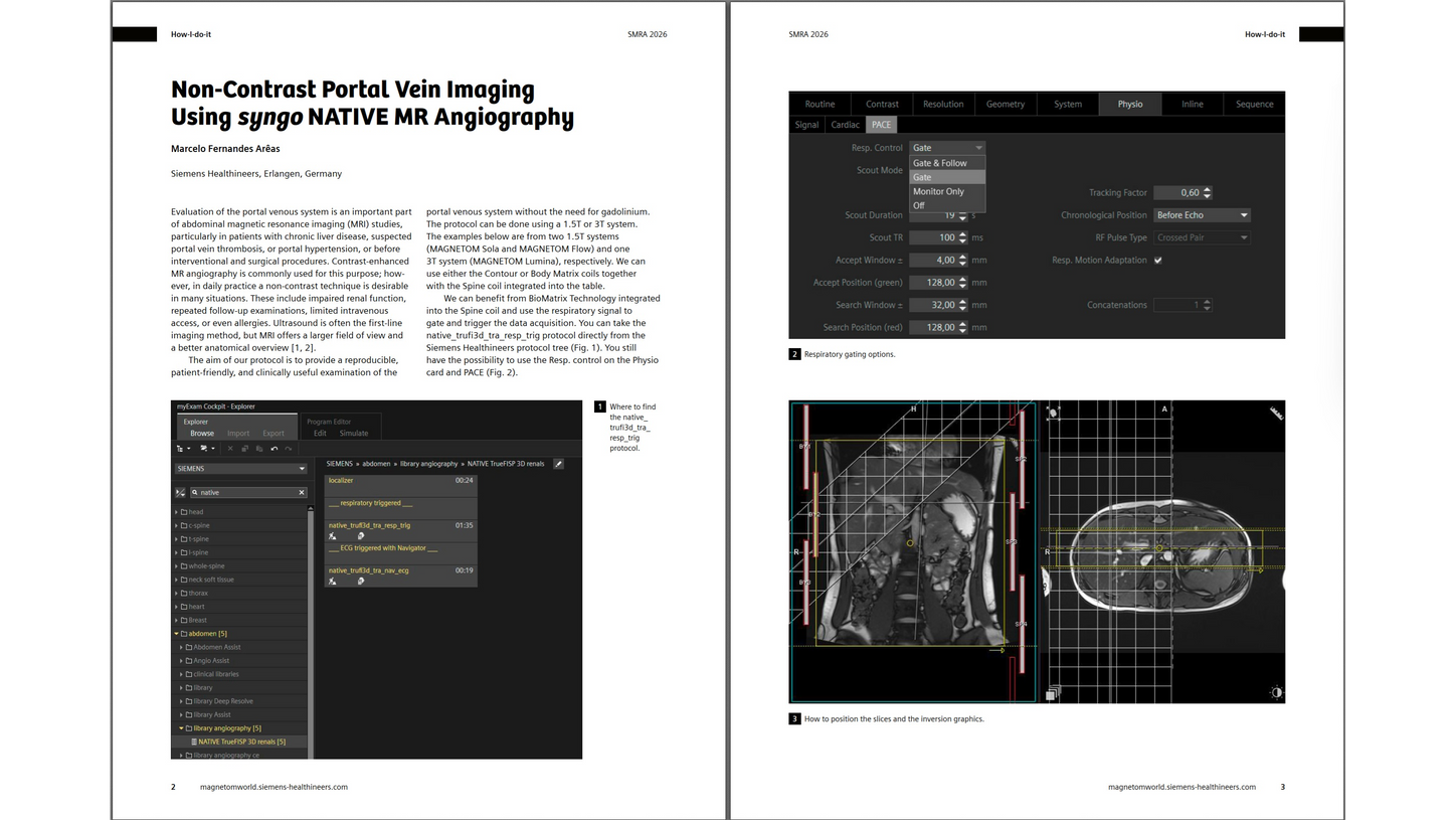 Siemens-healthineers_Magnetomworld_-Marcelo-Portal-Vein