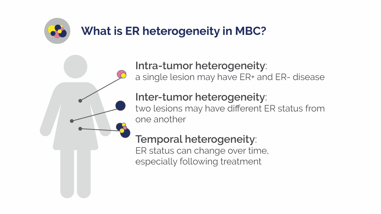 An infographic details what ER heterogeneity in MBC is.