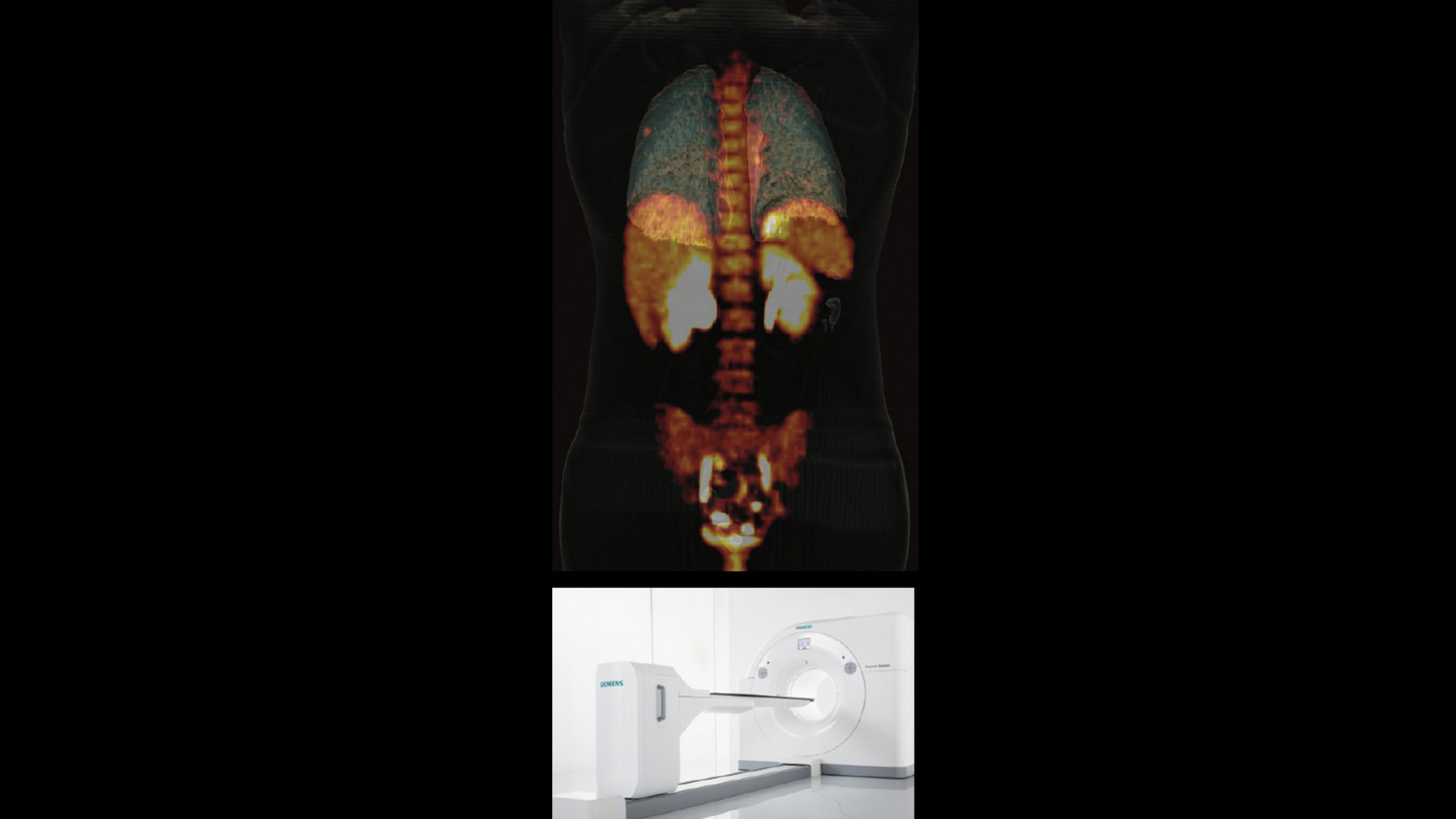 top: clinical image - bottom: Biograph Horizon PET/CT scanner