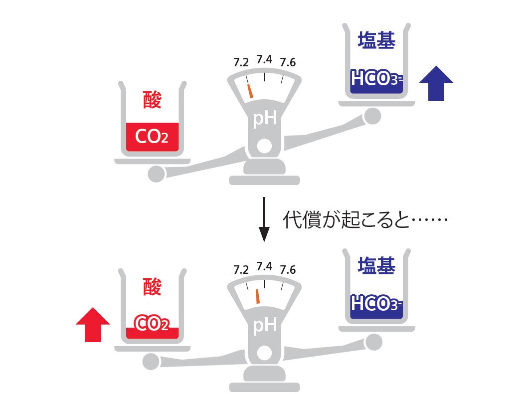 血液ガス分析かわら版⑦アシドーシス