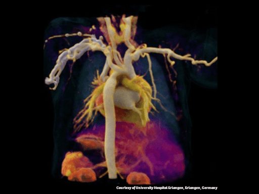 Chestrad How Lee Health is improving cardiac patient care with Dual Source CT ...