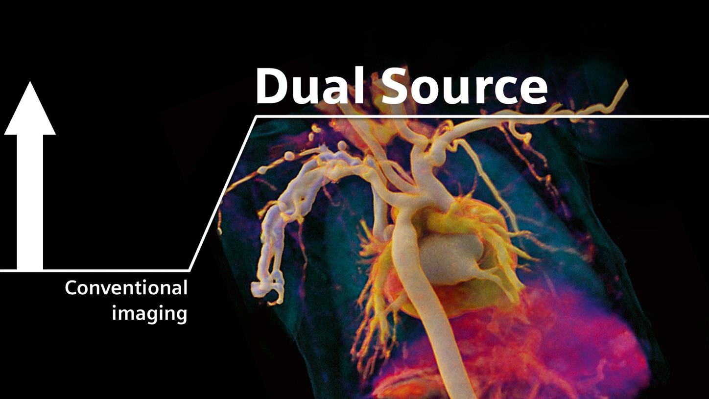 Erschließen Sie das ungenutzte Potenzial in der Kardiologie mit Dual Source.